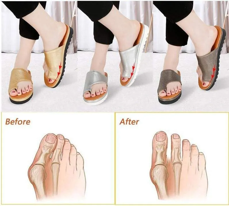 Orthopedic Bunion Correction Sandals - Women Comfy Platform Sandal Shoes for Toe Correction